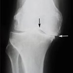 Prije početka uzimanja